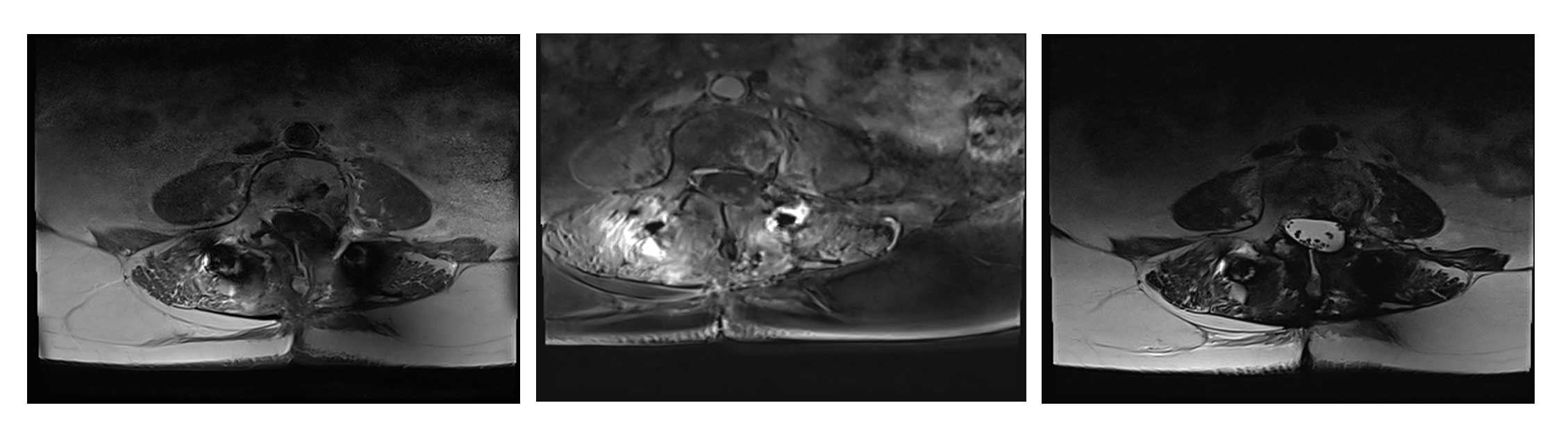 Ameliyat sonrası görüntü