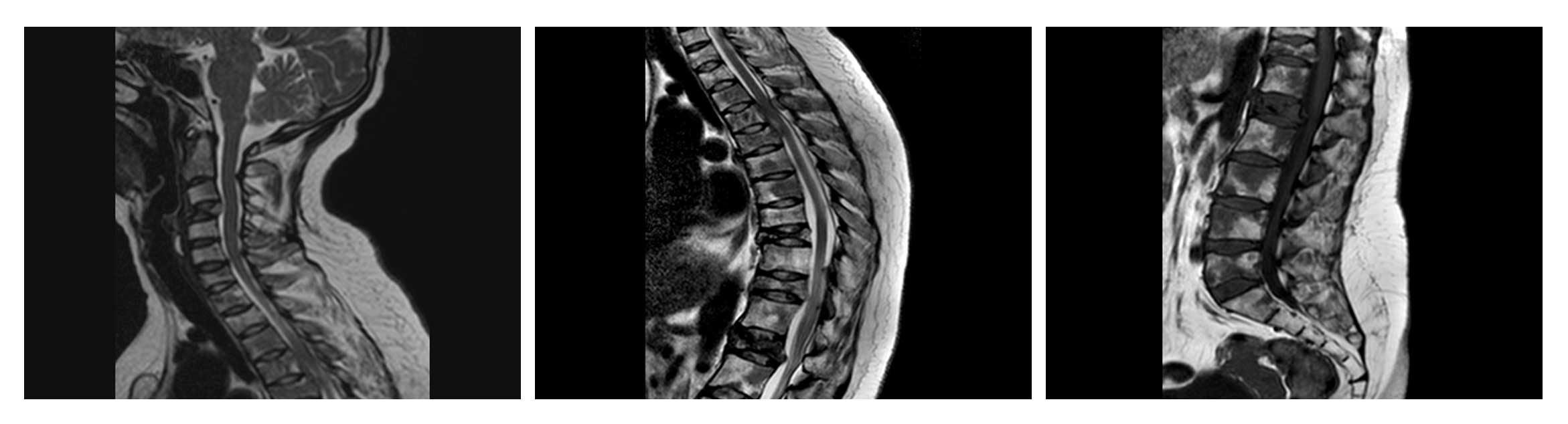 Ameliyat esnası görüntüsü