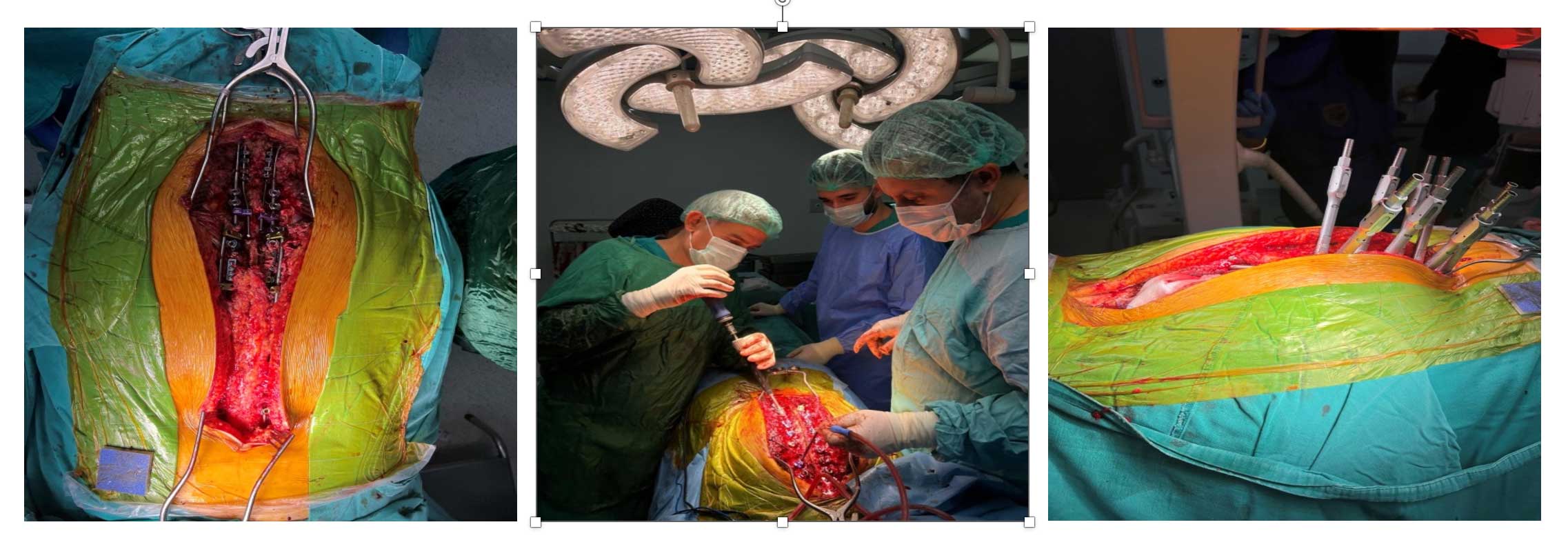 Ameliyat sonrası görüntü