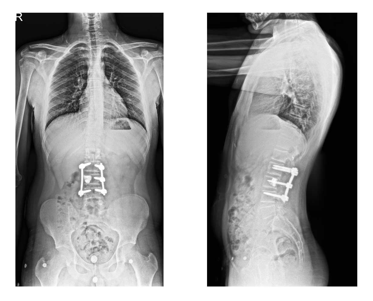 Ameliyat esnası görüntüsü