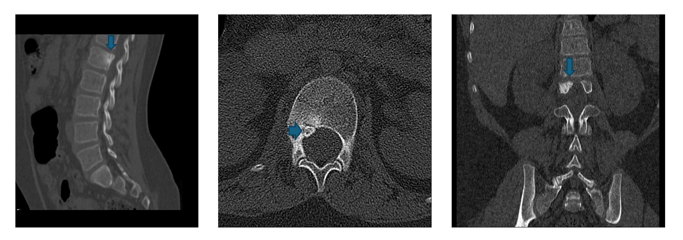 Ameliyat esnası görüntüsü