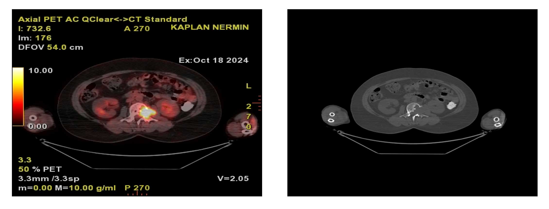 Ameliyat esnası görüntüsü