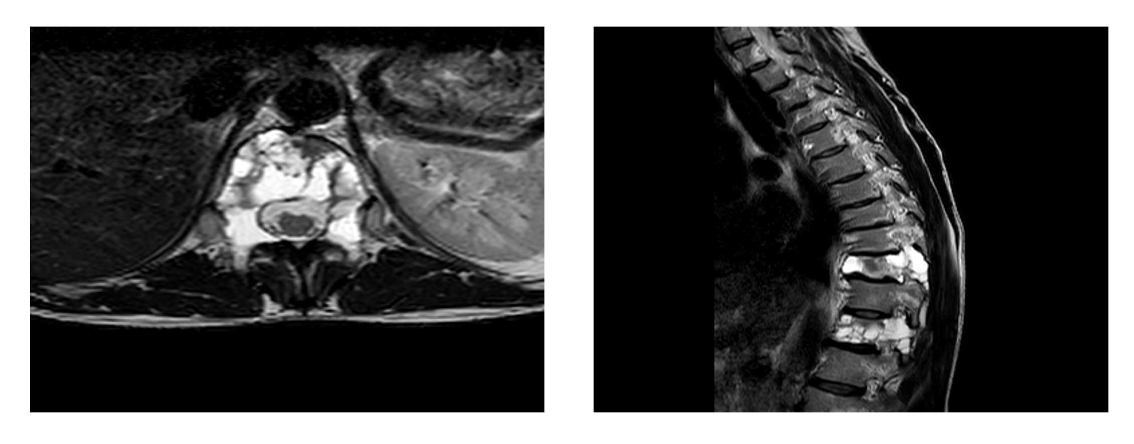 Ameliyat esnası görüntüsü